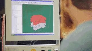 穿夹脚拖有什么危害,穿夹脚拖的好处和坏处