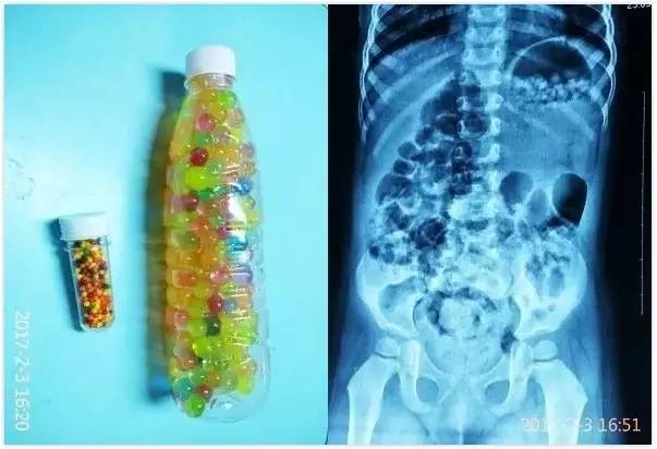 一岁宝宝误食异物多久发现,一岁宝宝误食的危险物