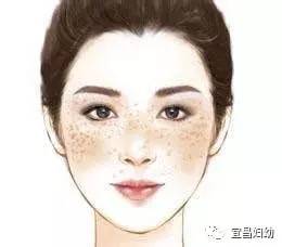 妇幼健康科普,哪个医院褐青色痣看得好