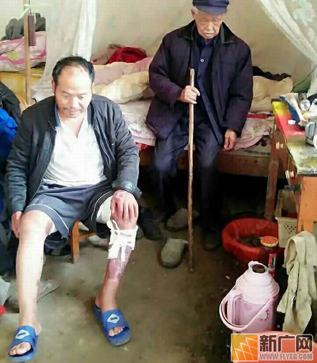 彝族村民李增贵烤贾酒盼脱贫遇火灾,栽多少包谷才能抚平49%烧伤