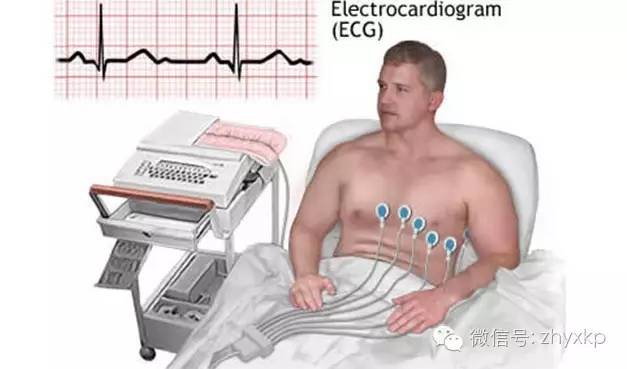 这项最便宜的检查，你做了吗？