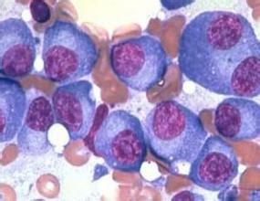 医生科普什么是软组织肉瘤,完整的医学学习笔记