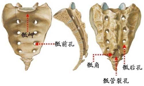 骶管注射药物治疗,骶管注射疗法治疗腰腿痛