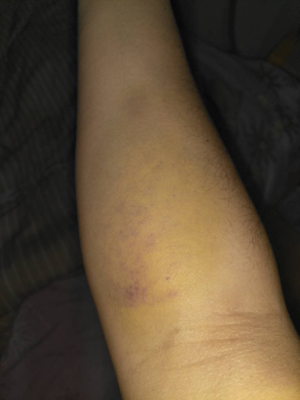 第一次献血体验,献血体验