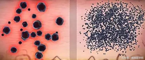 体会光的魔力，唤醒你的肌肤（很干的干货）