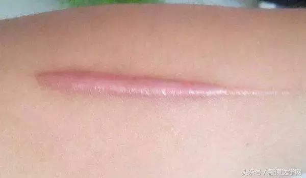 体会光的魔力，唤醒你的肌肤（很干的干货）