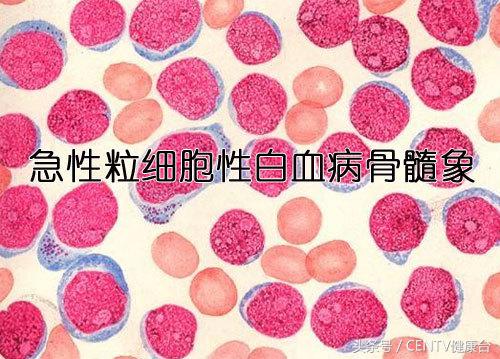 钻胯治病9元一次这样的奇耻大辱真的能治好白血病吗？