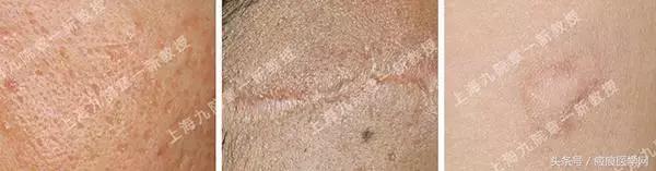 体会光的魔力，唤醒你的肌肤（很干的干货）