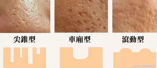 体会光的魔力，唤醒你的肌肤（很干的干货）