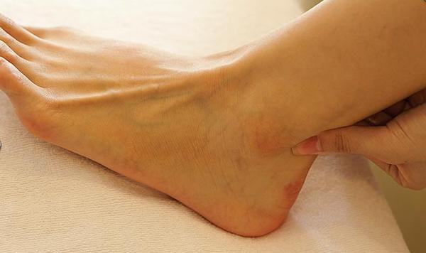 慢跑已经伤到膝盖怎么办,慢跑髌韧带拉伤