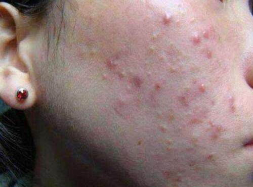 李时珍通便是真的吗,李时珍便秘的秘方