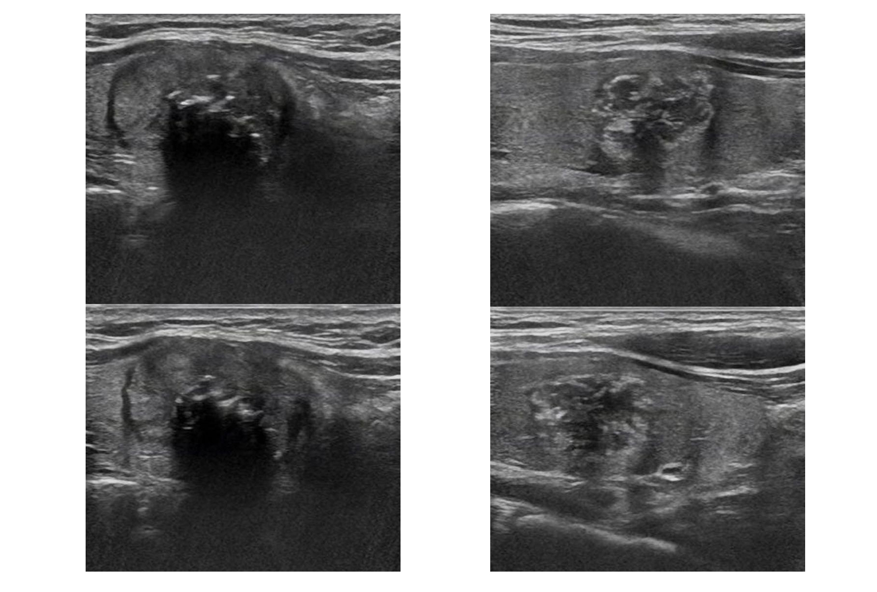 ai到底有多厉害,ai究竟有多厉害
