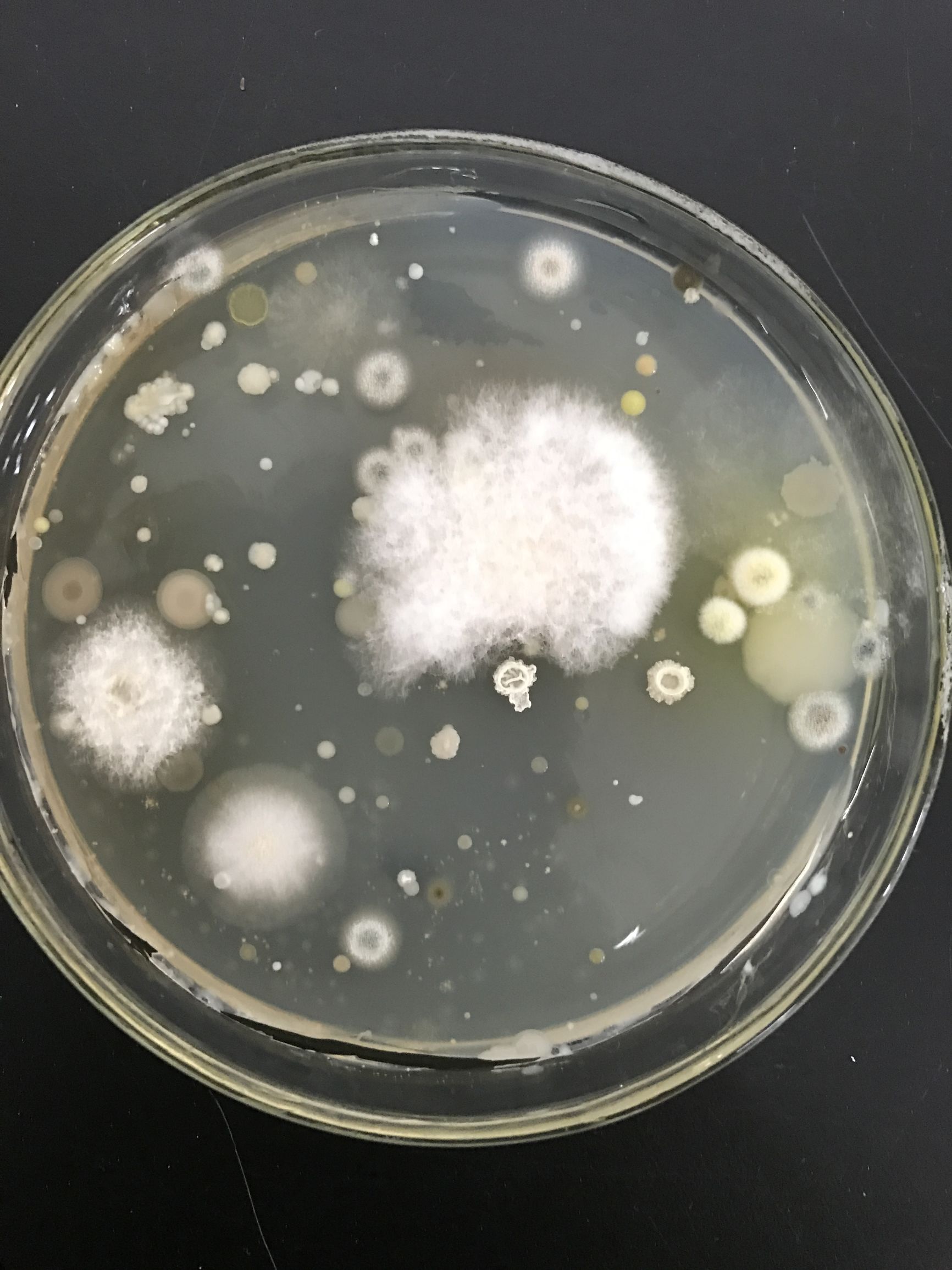 原来脚气菌长这样，三招教你治脚气