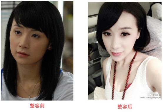 杨幂佟丽娅都给她做过配,但好像自从她整容消息传出后就少出现了