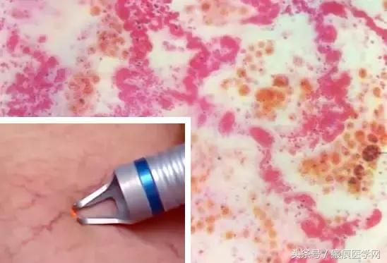 体会光的魔力，唤醒你的肌肤（很干的干货）