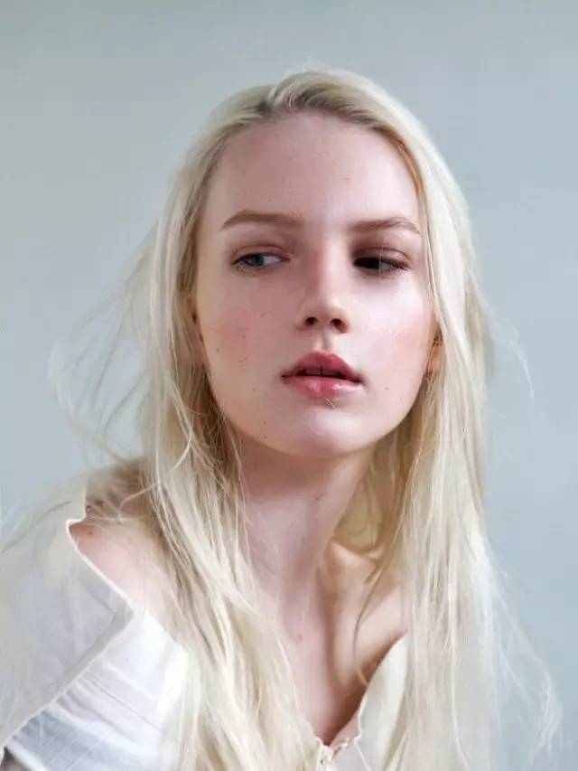 双眼皮手术该如何避免长期疤痕肉条不消肿?