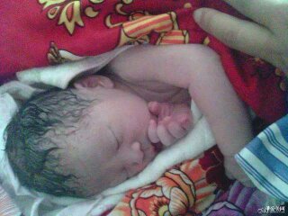 我的剖宫产经历,产后收腹的正确方法图解