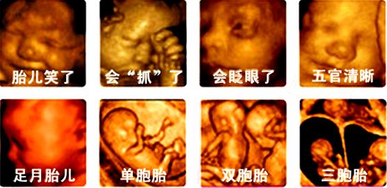 四维宝宝留念照,四维彩超单怎么保存做纪念