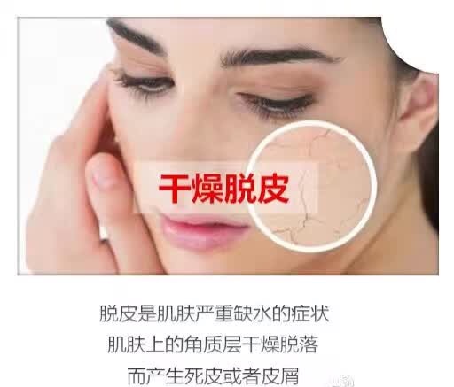 假性过敏的症状及治疗,什么是过敏怎么治