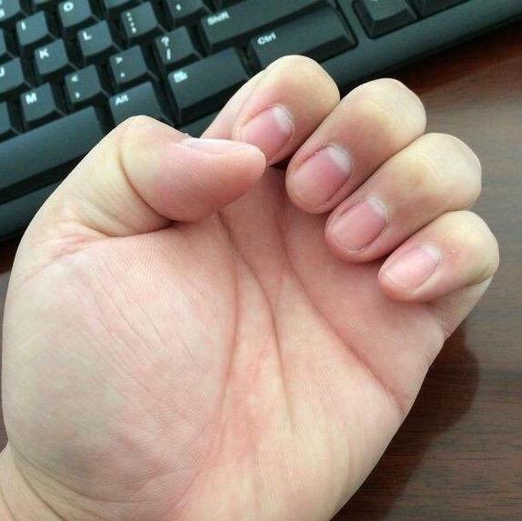 缺乏维生素会引起哪些皮肤问题,缺乏维生素和微量元素会得哪些病