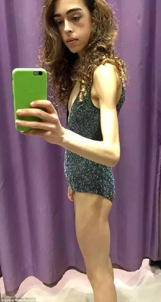 节食减肥的后果太可怕了图片,减肥路上总有些毒瘤