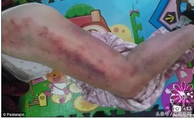 拍死7岁小孩“拍打拉筋神医”萧宏慈英国被抓粉丝仍力挺