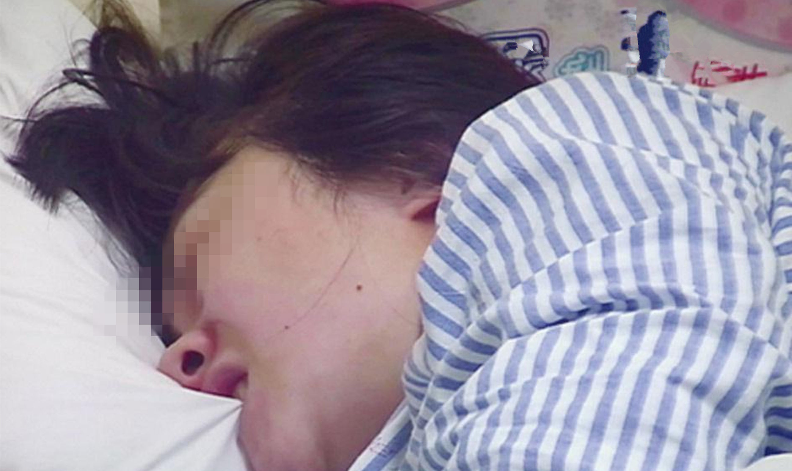 孕妇顺产下面撕裂多久能好,孕妇顺产撕裂缝针多久能恢复