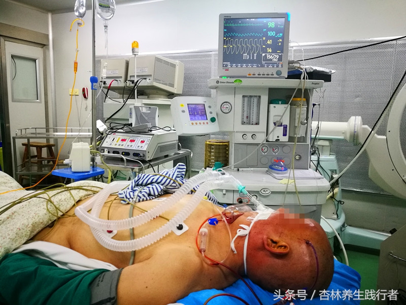 脑出血做开颅手术能活多少年,脑出血开颅手术以后能活多少年