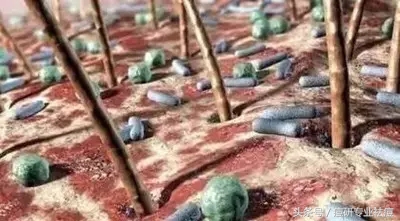 长痘上密密麻麻的虫子是什么,痘痘里面的虫子是什么