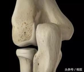 桡骨头和桡骨小头一样么,桡骨小头在哪一侧图片