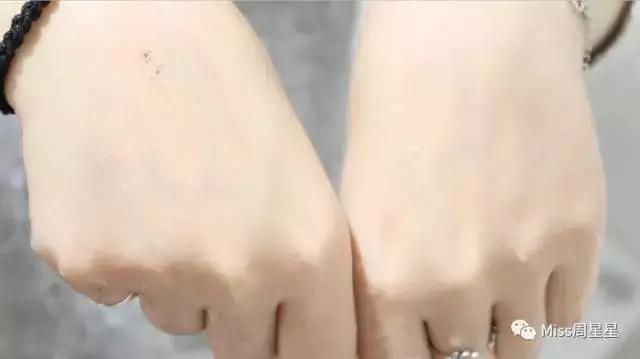 绉戝绉嶈崏,绉戝鎶よ偆鐩茬洰绉嶈崏