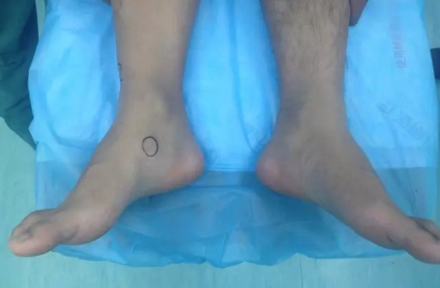 踝关节疼痛病因病机,踝关节伤病