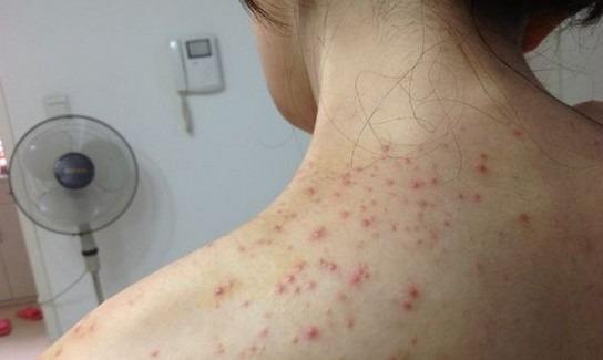 如何消除小肚子湿气,小肚子大湿气重效果最好的办法