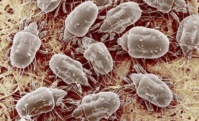 孩子身上痒起小红疙瘩怎么回事,小孩身上起红疙瘩很痒怎么办