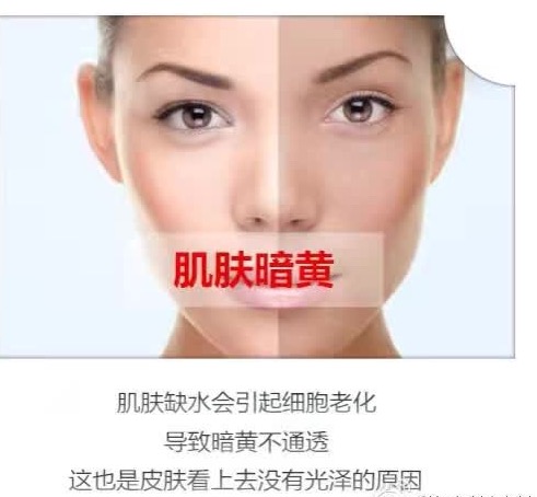 假性过敏的症状及治疗,什么是过敏怎么治