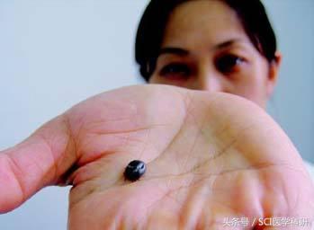 人见人怕的蜱虫含有特殊蛋白,是治疗人类超级细菌药物的唯一原料