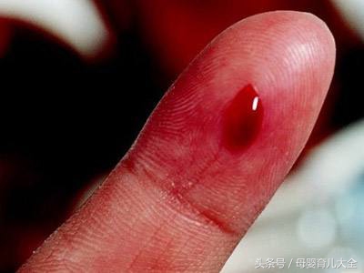 宝宝意外受伤正确处理方法,幼儿意外受伤的预防及处理方法