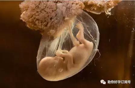 羊水是婴儿细胞还是母体细胞,羊水是胎儿的基因吗