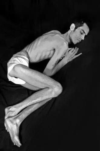 节食减肥的后果太可怕了图片,减肥路上总有些毒瘤