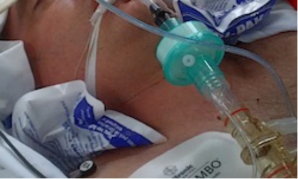 急需熊猫血？《外科风云》里的低温疗法并没有什么用