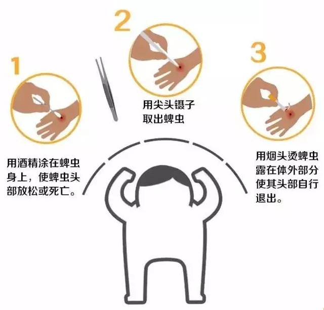 蚊子皮肤细菌感染溃烂,蚊虫叮咬可以拍吗