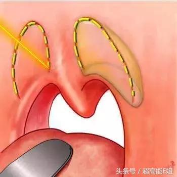 旅途中最令人尴尬的一件事，韩红听了也想打人