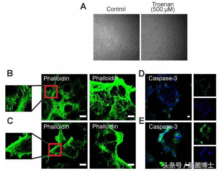 香氛疗法?有望成为结直肠癌治疗的一种新方法