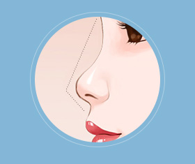 蒜头鼻鼻基底凹陷嘴凸,蒜头鼻和鹰钩鼻图片