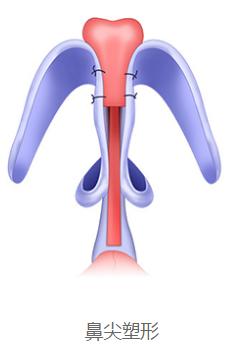 蒜头鼻鼻基底凹陷嘴凸,蒜头鼻和鹰钩鼻图片