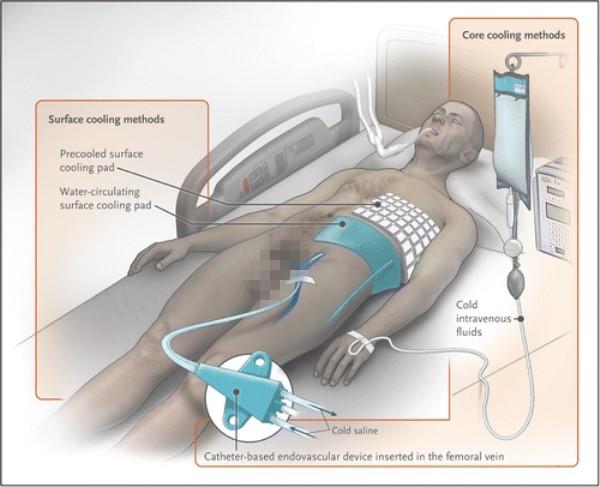 急需熊猫血？《外科风云》里的低温疗法并没有什么用