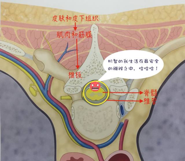 腰腿疼是椎管肿瘤吗,腰腿疼痛需要注意脊髓肿瘤吗