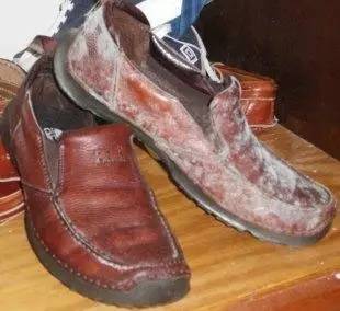 衣柜里的鞋子发霉了,夏季衣服鞋子柜子发霉怎样处理