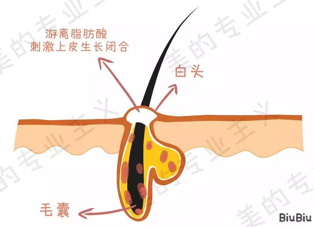 大美人祛斑美白,大美人祛痘