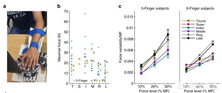六指一般多出哪一个手指,六指多出的手指叫什么